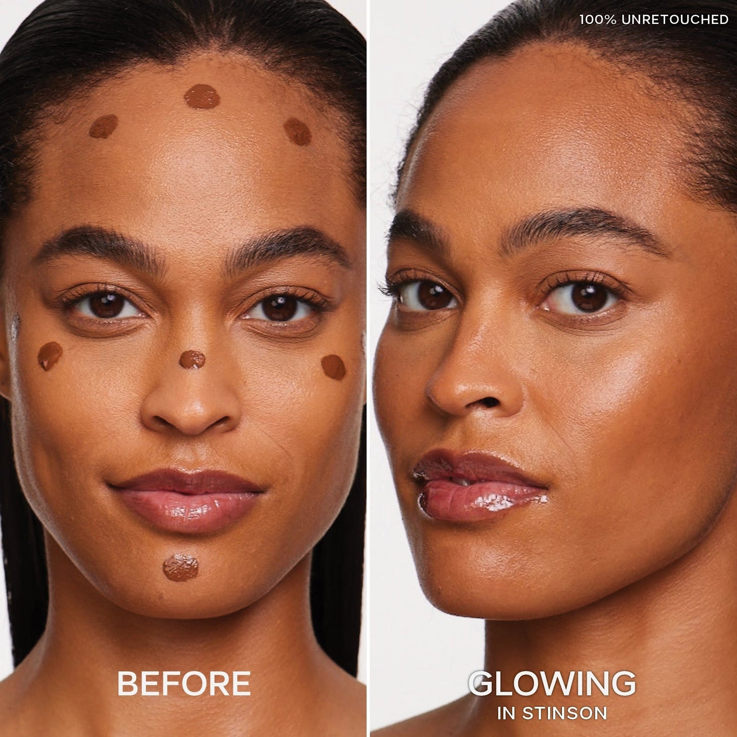 Dew Bronze™ Duo